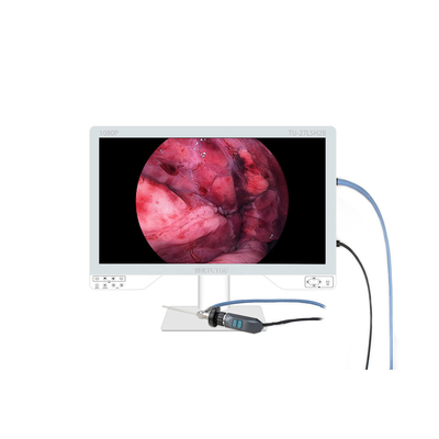 Últimas noticias de la empresa sobre Las cámaras portátiles de endoscopio aportan precisión y flexibilidad al diagnóstico moderno