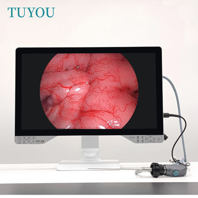 comprar U Disco 27 pulgadas 1080P Full HD 4 en 1 Sistema de Artroscopio Médico Histeroscopio Endoscopio Cámara fabricación en línea
