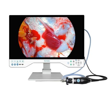 comprar Sistema de cámara de ENT todo en uno con cámara portátil de endoscopio HD y fuente de luz fabricación en línea