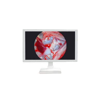 comprar Equipo médico FHD 22 24 27 pulgadas Endoscopio Monitor de cámara Display Monitor médico Full HD fabricación en línea