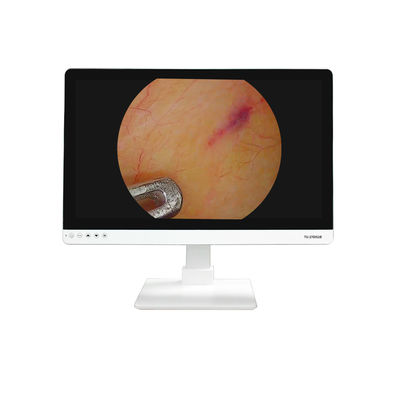 comprar Equipo médico 4K FHD 27 pulgadas de cámara de endoscopio pantalla de monitor para endoscopio fabricación en línea