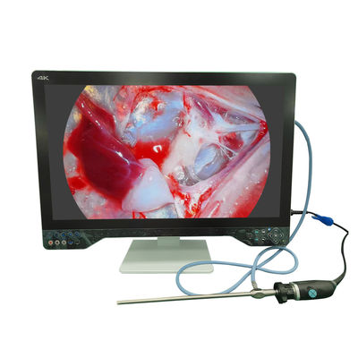 comprar Cámara de endoscopio de ultra alta definición 4K para laparoscopia con monitor de 32 pulgadas y fuente de luz fabricación en línea