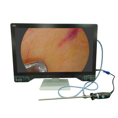 comprar Sistema de cámara de endoscopio médico de 32