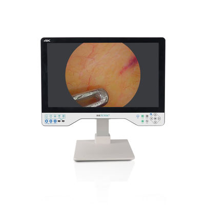 comprar Monitor laparoscópico de 24 pulgadas 4K Endoscopio UHD Sistema de cámara LED quirúrgico con fuente de luz fabricación en línea