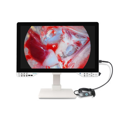 comprar Kit de cámara de endoscopio quirúrgico Full HD con fuente de luz y monitor de 27' para ginecología fabricación en línea