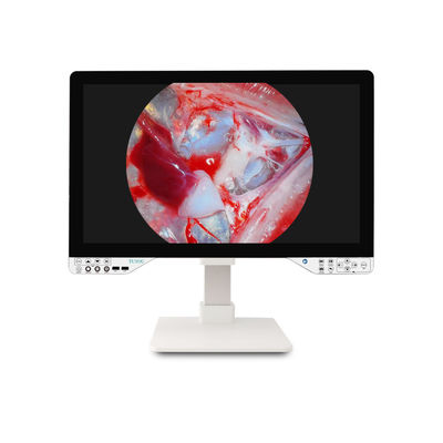 comprar Sistema de cámara endoscópica FHD de 27 pulgadas para cirugía ginecológica con fuente de luz y monitor integrados fabricación en línea