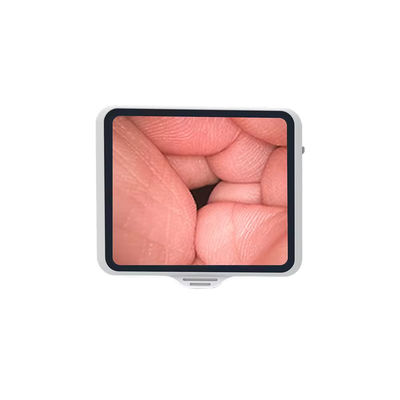 comprar Endoscopio flexible de clase I TUYOU con pantalla de 3,5 pulgadas reutilizable para el zoom de broncoscopía de fibra óptica fabricación en línea