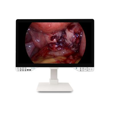 comprar Sistema de cámara de grado médico de 27 pulgadas con función de llave Shoutcut y tipo de lente de fibra óptica fabricación en línea
