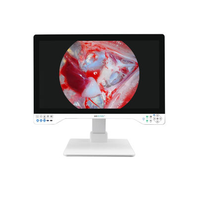 comprar Cámara de endoscopia avanzada de 32