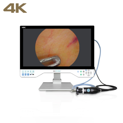 comprar Sistema de cámara de endoscopia FHD todo en uno TUYOU con monitor quirúrgico de 24