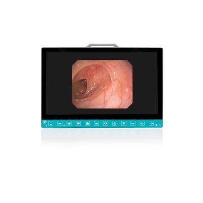 comprar TUYOU 13.3-Inch FHD Flexible Endoscope Camera System Multi-Color OEM Custom All-in-One Portable Uro-Gyn TikTok Hit fabricación en línea