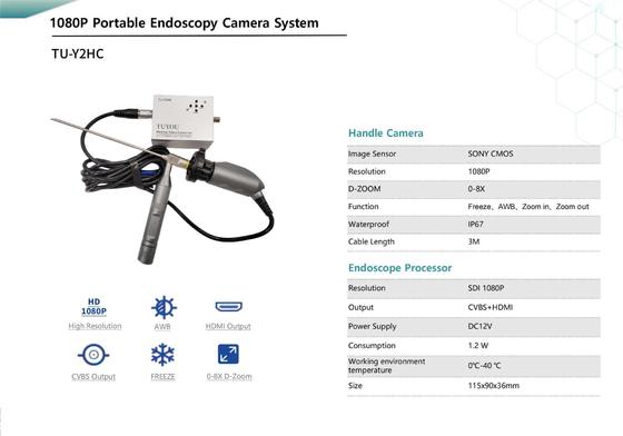 comprar Cámara de endoscopio médico portátil TUYOU TU-Y2HC FHD con HDMI/CVBS PARA OÍDOS, NARIZ Y GARGANTA (ORL), Zoom digital 0-8X fabricación en línea