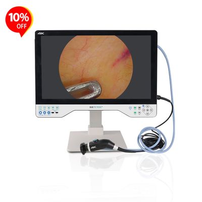 comprar All-in-one Camera System With 24 Inches Monitor For Laparoscopy ENT Surgery Manufacturer  fabricación en línea