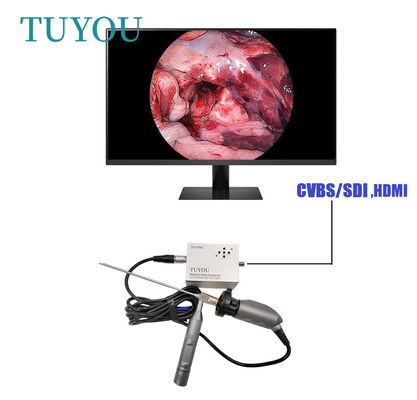 Full HD Electrónico Portátil ENT Endoscopio Cámara Médica para computadora portátil