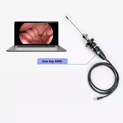 Cámara de endoscopio USB portátil eléctrica Full HD CMOS para ENT Otoscopio nasal Oído Ginecología laparoscópica