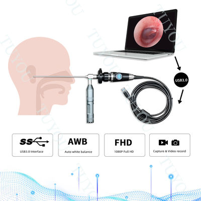 Cámara portátil USB3.0 de endoscopio para la inspección médica de ENT