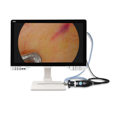 Endoscopio de 27 pulgadas 4K para cirugía laparoscópica con fuente de luz y monitor