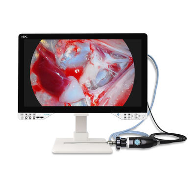 AC110V-250V Cámara de endoscopia 4K ENT con fuente de luz y monitor