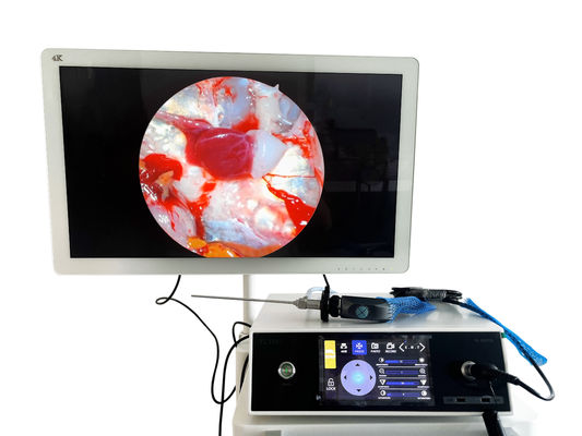 Full HD 1080P cámara de endoscopia portátil con pantalla táctil y fuente de luz LED