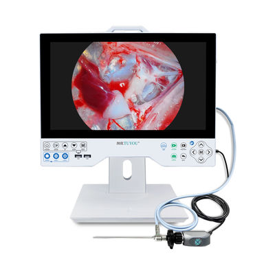 Monitor LCD portátil con cámara de endoscopio HD para ENT/Laparoscopia/Histeroscopia/Urología
