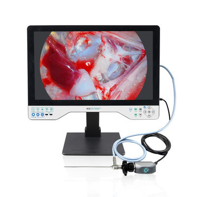 Sistema de cámara de endoscopio HD todo en uno para ENT, urología y endoscopia laparoscópica