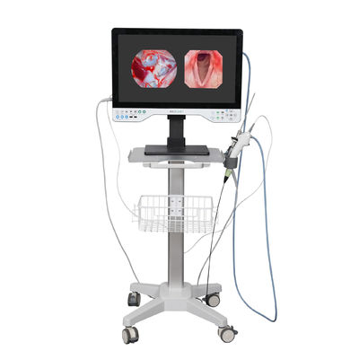 FHD todo en un sistema de cámara de endoscopio con luz LED incorporada y alcance flexible para laparoscopia