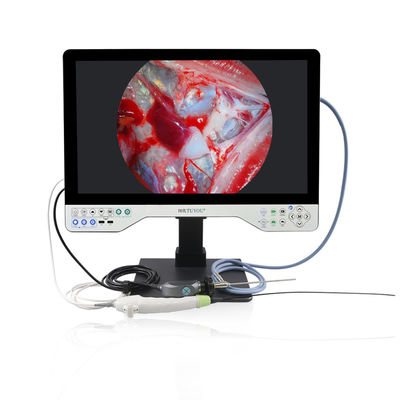 Selección del modo de monitor de 15 pulgadas TUYOU Cámara de endoscopio médico todo en uno con fuente de luz para urología y ginecología