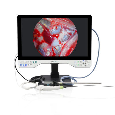 Sistema de cámara de endoscopio rígido y flexible multifuncional TUYOU 1080P para laparoscopia