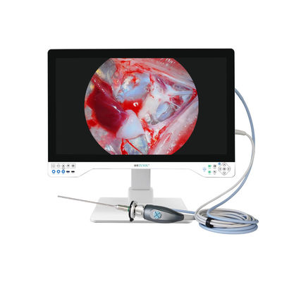 Sistema de cámara de endoscopio 4K integrado con luz LED con monitor médico de 32 pulgadas