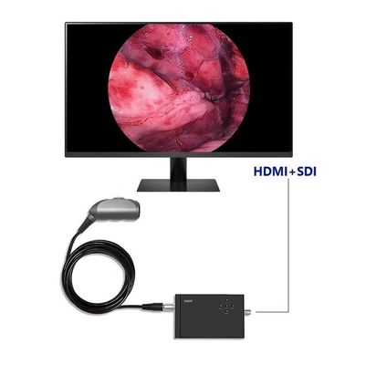 TUYOU Cámara de video portátil de endoscopia Full HD 1920x1080 Resolución 120 grados Campo de visión para la urología de la columna vertebral y la cirugía ENT