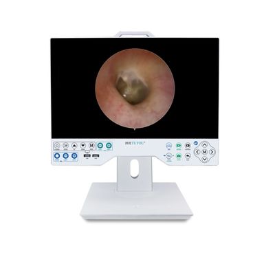 Diseño de fábrica Sistema de cámara FHD de 15 pulgadas con endoscopio flexible y rígido compatible con el registro
