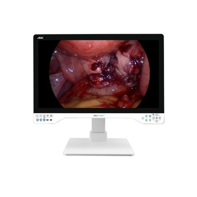 Fabricante profesional de cámara de endoscopia 4K de 32 pulgadas con fuente de luz integrada para el sistema laparoscópico