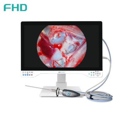 Sistema de cámara de endoscopia FHD TUYOU todo en uno con monitor quirúrgico de 32 pulgadas para procedimientos de ENT y urología