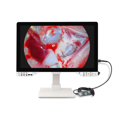 Sistema de cámara de endoscopio FHD de 27 pulgadas con luz LED de 100W para cirugía ENT