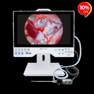 Cámara de endoscopio médico TUYOU de 15.6 pulgadas con fuente de luz LED incorporada, sensor CMOS SONY e interfaces de salida múltiple para urología laparoscópica, otorrinolaringología