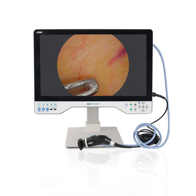 TUYOU 24 pulgadas 1080P cámara de endoscopio con IPX8 impermeable 8 horas de duración de la batería y 2 años de garantía para la endoscopia médica