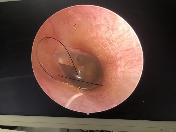 Monitor LCD portátil todo en uno HD Endoscopia cámara para ENT Laparoscopia Histeroscopia Urología 2