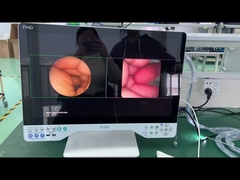 24 pulgadas rígido y flexible todo en un sistema de cámara de endoscopio