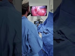 Sistema de cámara TU-LSD90TB 2 en 1 con fuente de luz fría para laparoscopia y ENT