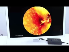 TU-Y5D101B Cámara de endoscopia Full HD con luz ajustable para ENT y cirugía laparoscópica