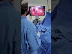 Se aplicará el procedimiento siguiente: