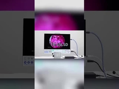 TUYOU Full HD 1080P 15.6 pulgadas Sistema de cámara de endoscopia médica todo en uno para ENT Sinus Urología
