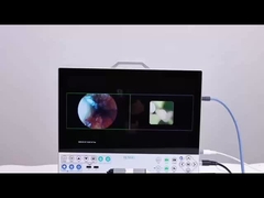TUYOU 15.6 Full HD 1080P Inch All In One Sistema de cámaras de endoscopia médica para urología de los senos paranasales